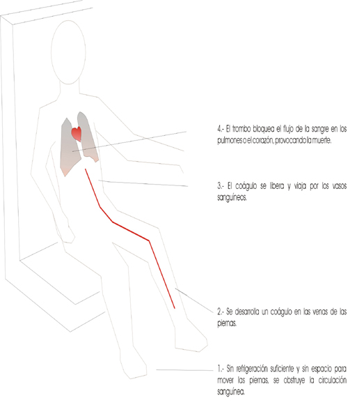 Infografía trombosis