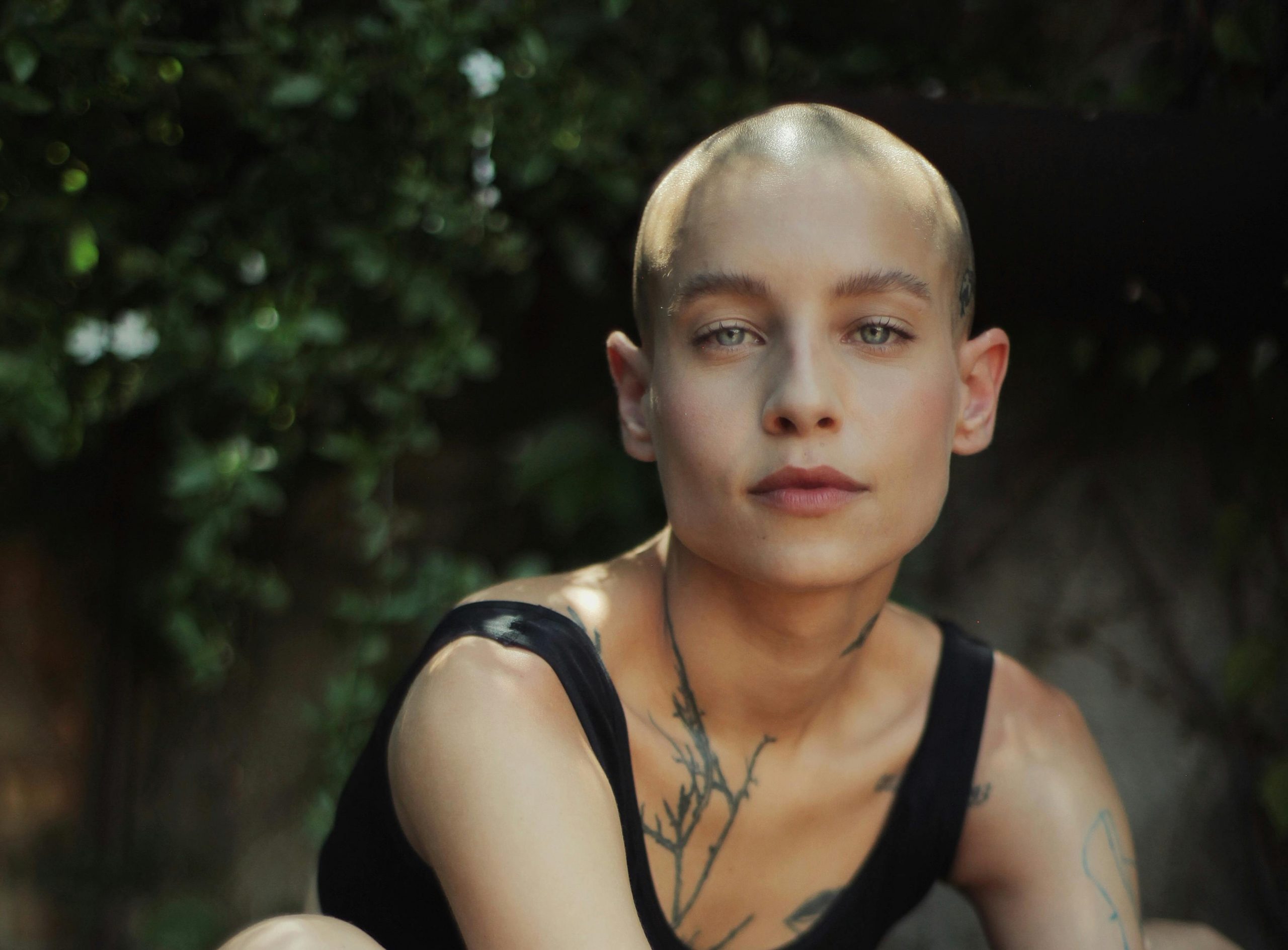Mujer joven alopecia, calvicie