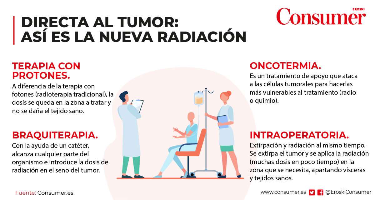 radioterapia ultima tecnologias