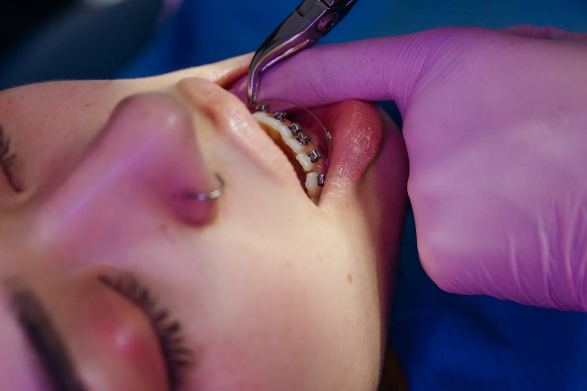 maloclusión dental tratamiento