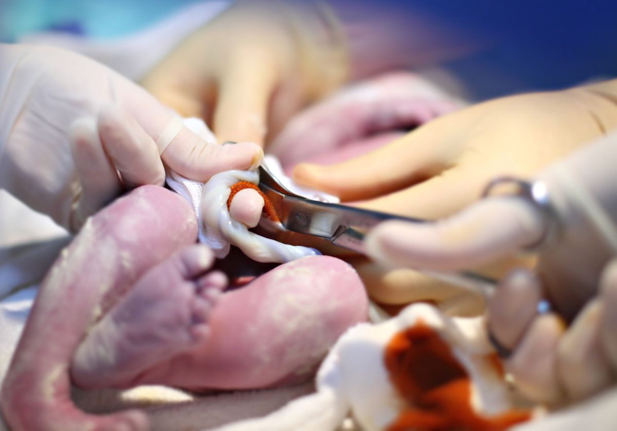 cordón umbilical bebé placenta