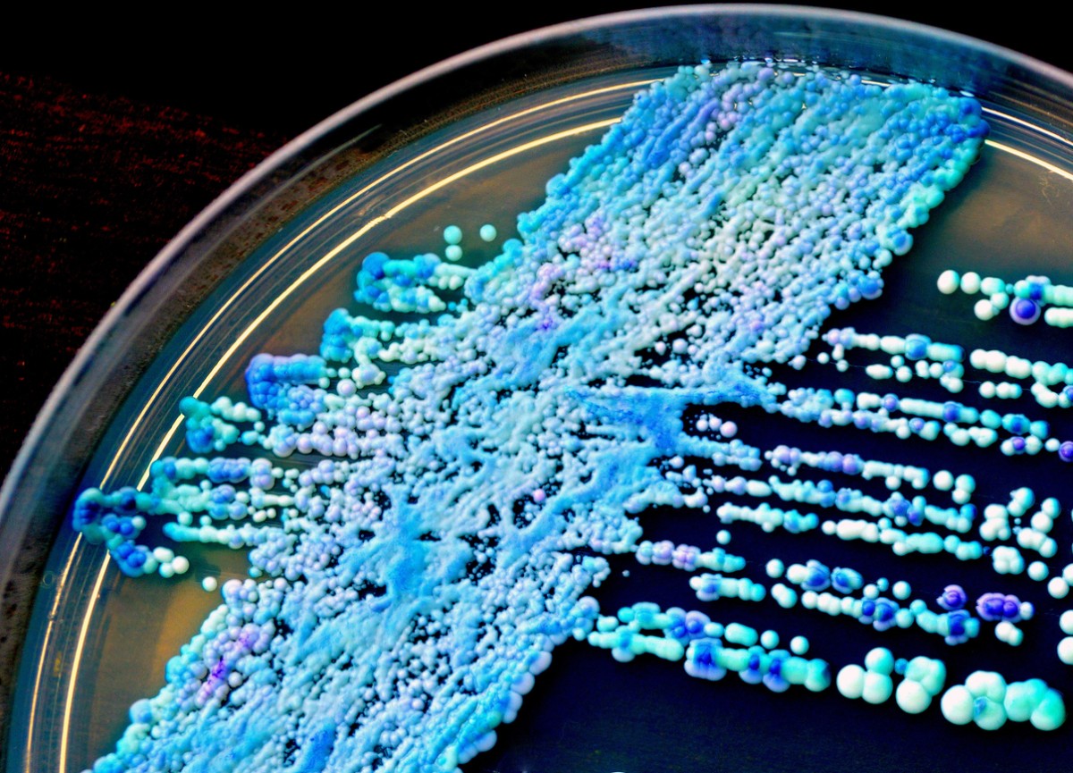 detección precoz de candida auris