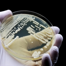 prevenir candida auris en hospitales con nueva herramienta