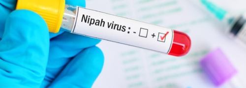 virus nipah síntomas
