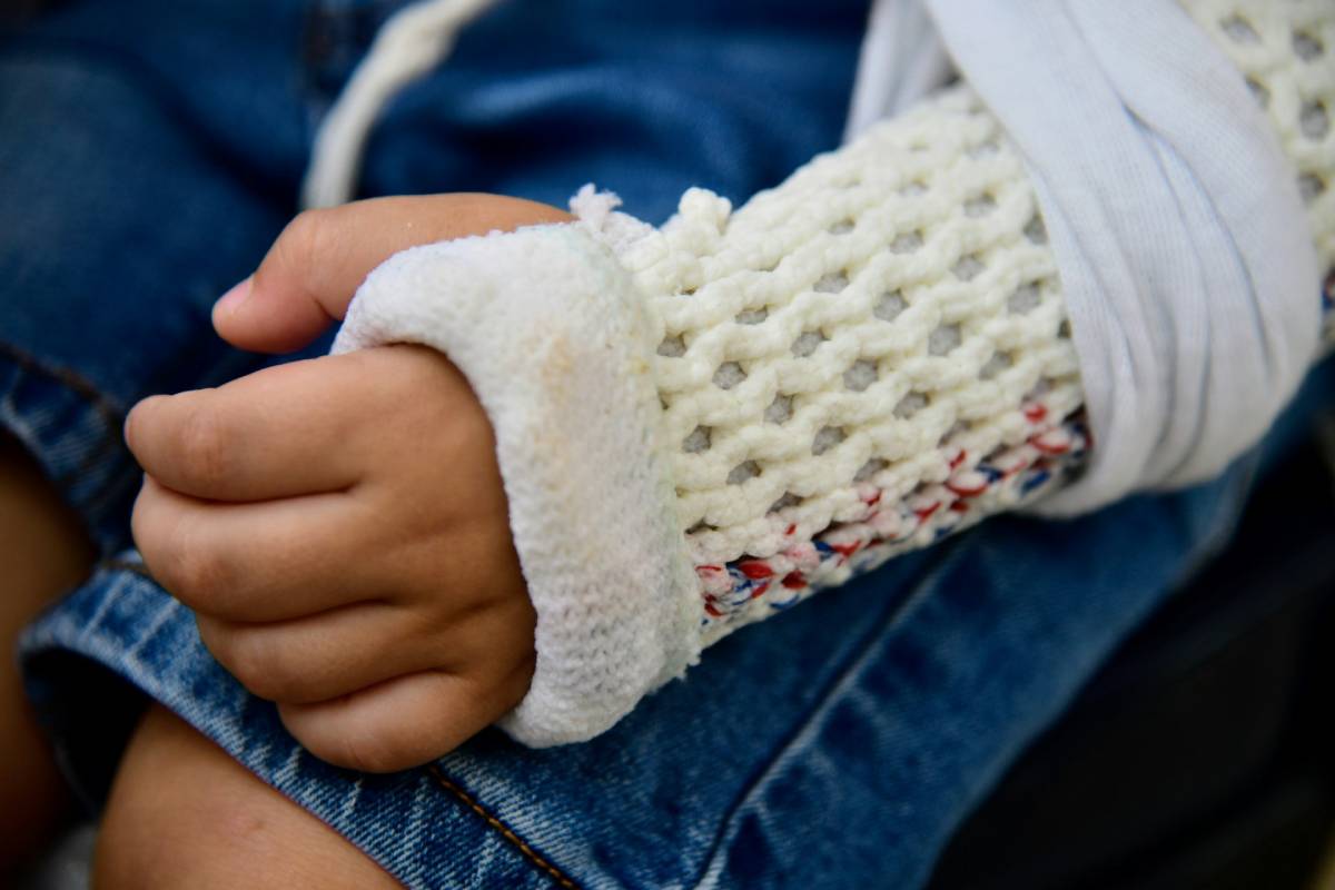 escayola brazo niño