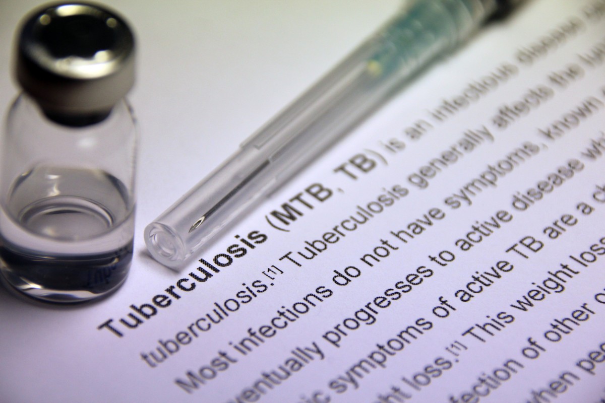 tratamiento de la tuberculosis