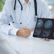 investigación sobre el daño cerebral adquirido
