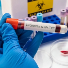 riesgos de tener la lipoproteína elevada