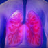 trasplante pulmonar requisitos