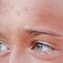 sudor frente