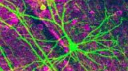 Img neuron listado