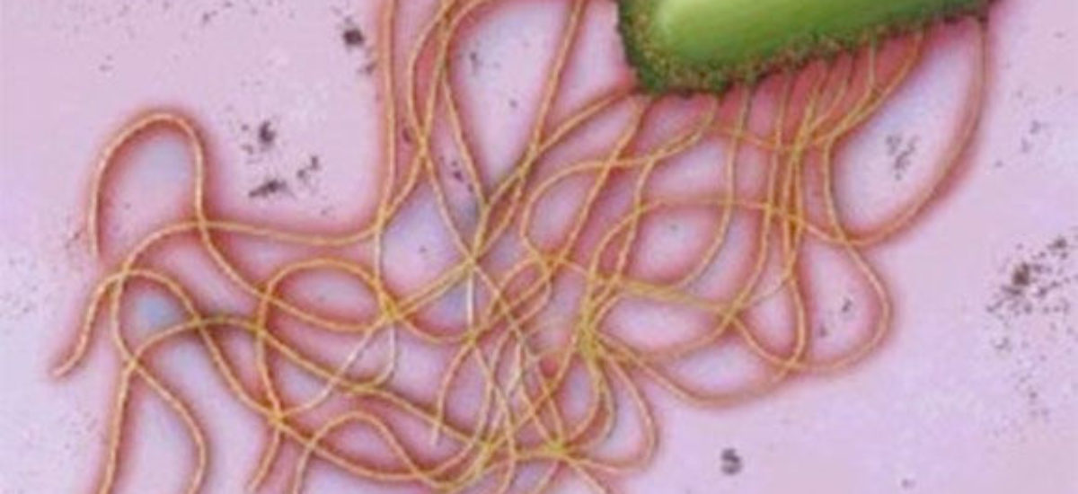 img_salmonella-10 Img salmonella