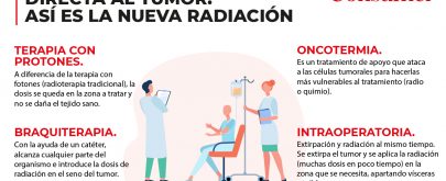 radioterapia ultima tecnologias