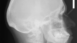 Img radiografia mandibula