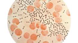 Img streptococcus pneumoniae