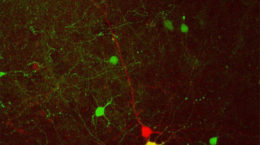 Img neuronas