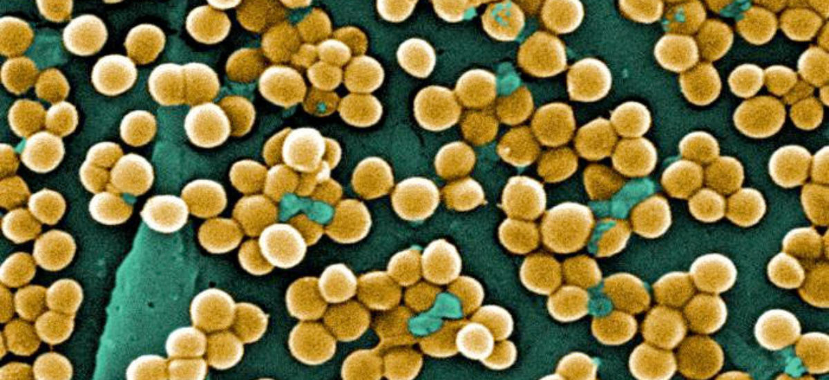 img_staphylococcus-aureus Img staphylococcus aureus