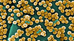 Img staphylococcus aureus