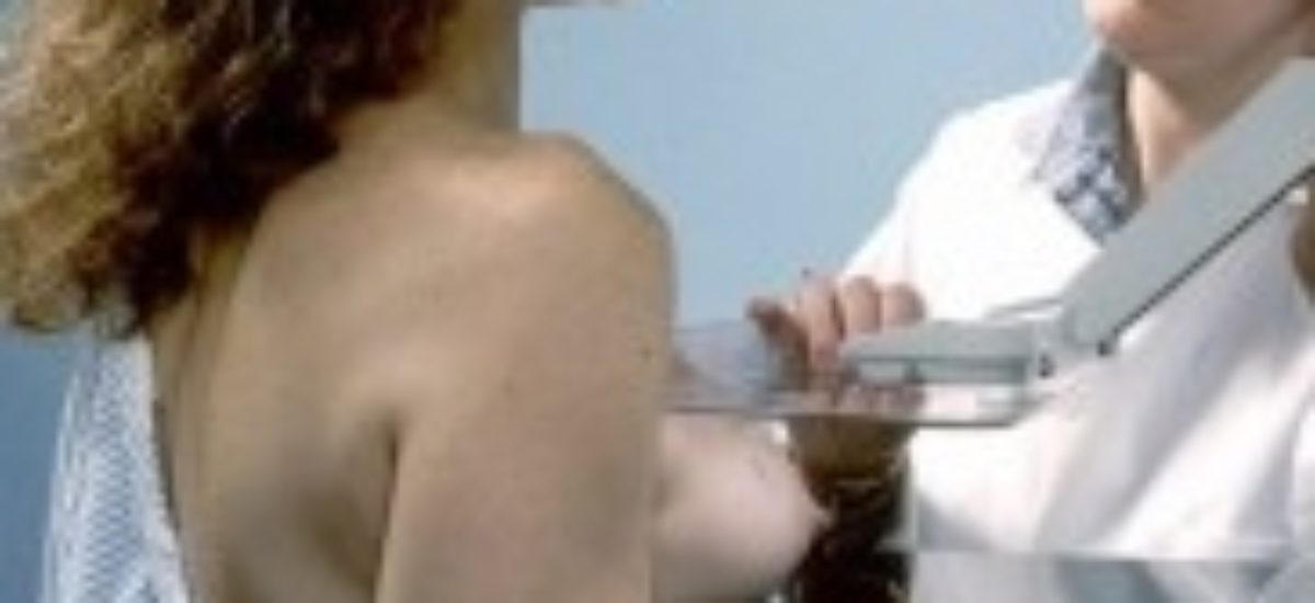 img_mammografia1-listado Img mammografia1 listado