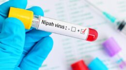 virus nipah síntomas