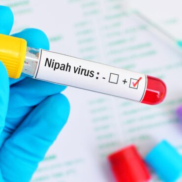 virus nipah síntomas