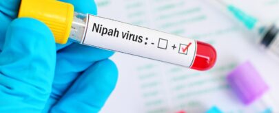 virus nipah síntomas