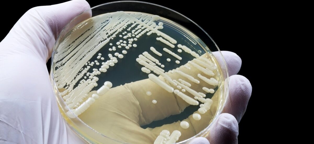 prevenir candida auris en hospitales con nueva herramienta