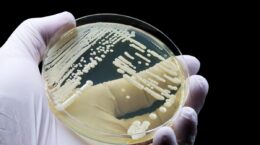 prevenir candida auris en hospitales con nueva herramienta
