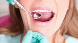 extracción de muelas del juicio