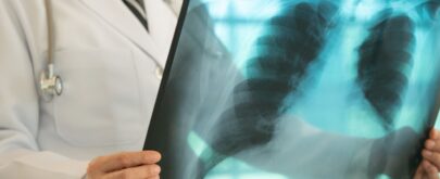 diagnóstico de tuberculosis