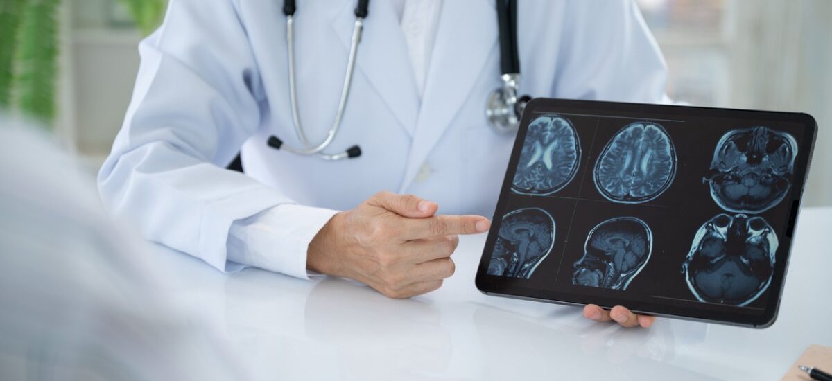 investigacion-dano-cerebral investigación sobre el daño cerebral adquirido
