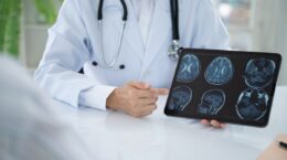 investigación sobre el daño cerebral adquirido