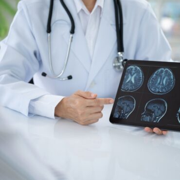 investigación sobre el daño cerebral adquirido