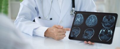 investigación sobre el daño cerebral adquirido
