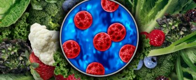 ciclosporiasis prevención
