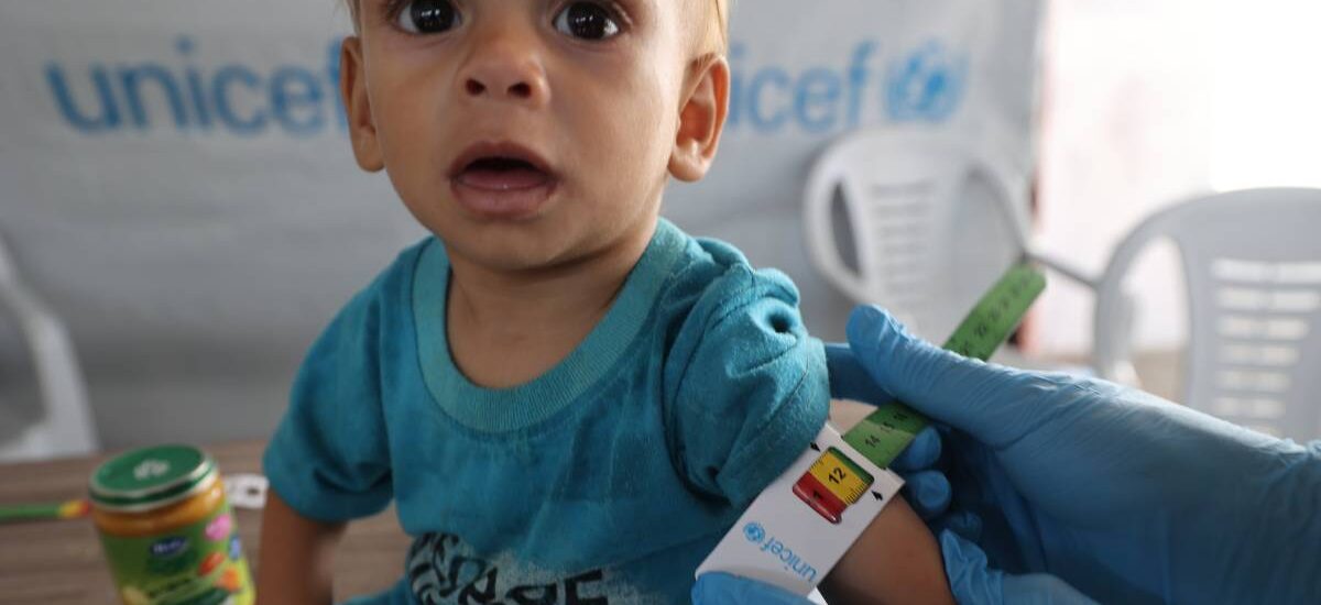 raed-karam-gaza desnutrición infancia gaza