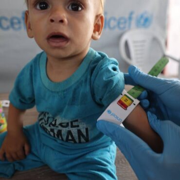 desnutrición infancia gaza