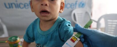 desnutrición infancia gaza