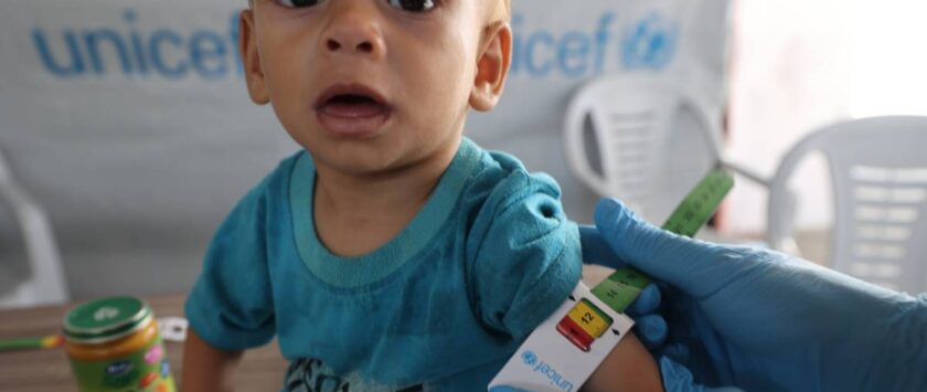 desnutrición infancia gaza