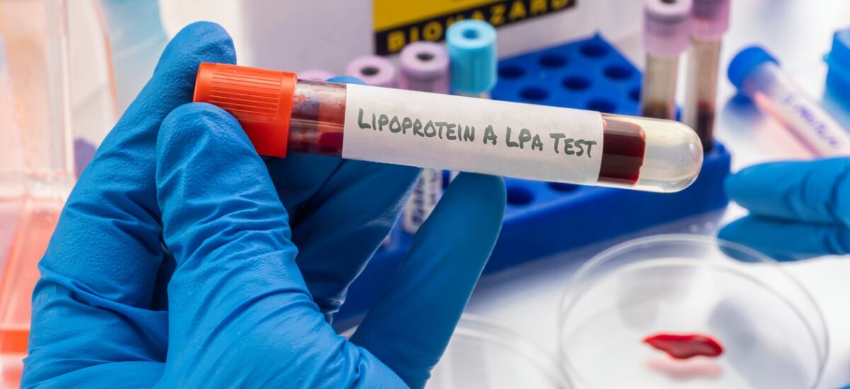 riesgos de tener la lipoproteína elevada