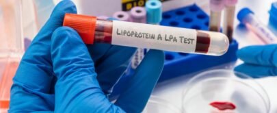 riesgos de tener la lipoproteína elevada