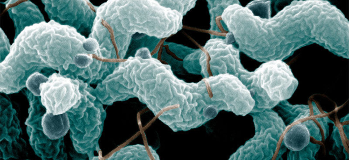 img_campylobacter-8 Img campylobacter