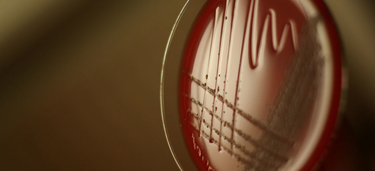 img_bacteria.adn_.hd_-3 Img bacteria adn hd