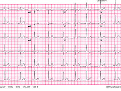 Img EKG1