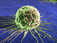 Img cancercell1