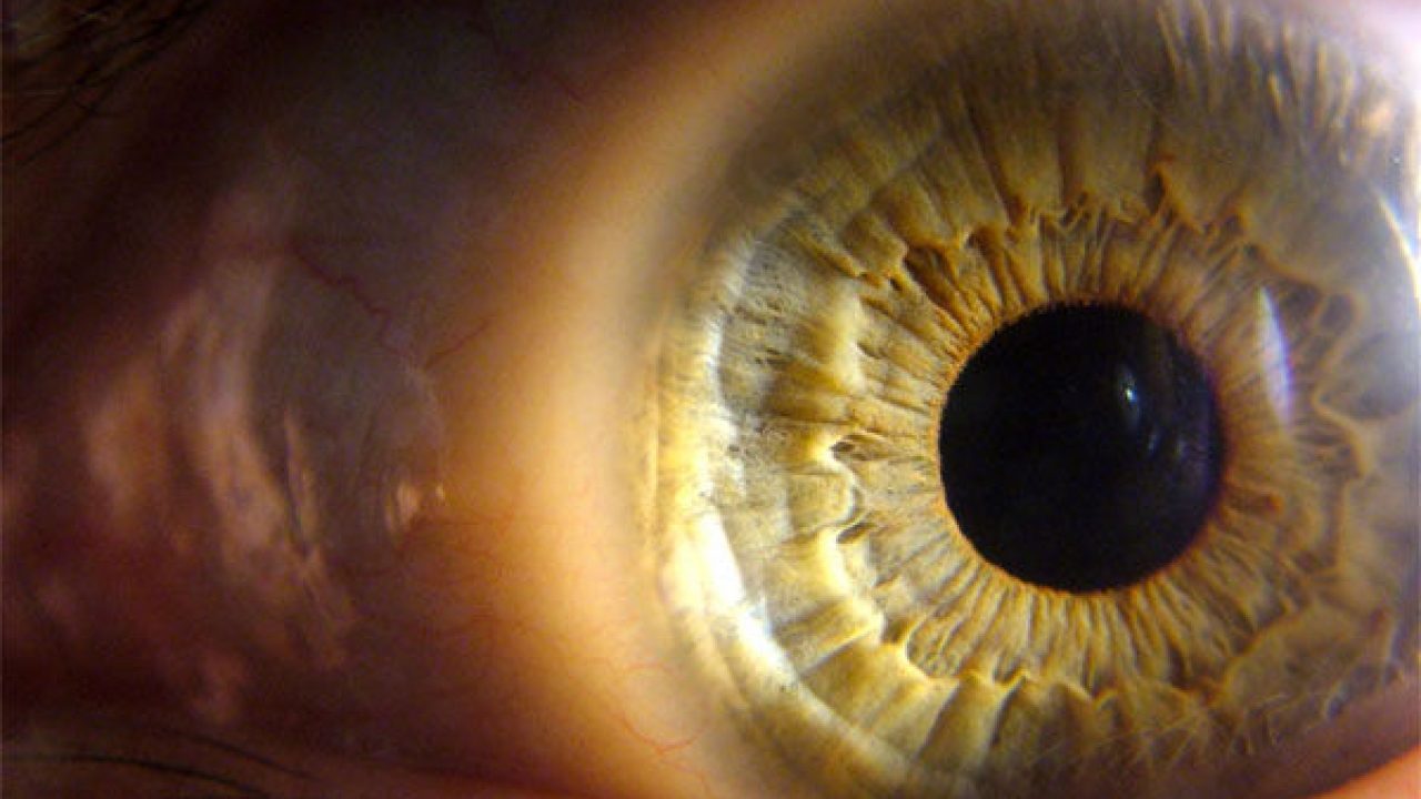 factori de risc pentru pierderea vederii vederea se deteriorează cu nasul curgător
