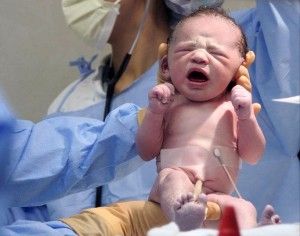 Img partos cesareas como consejos peligros seguridad embarazos art