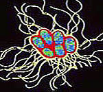 Img salmonella1