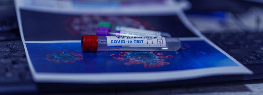 Precios test coronavirus