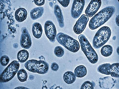 Antecedentes del riesgo microbiano
